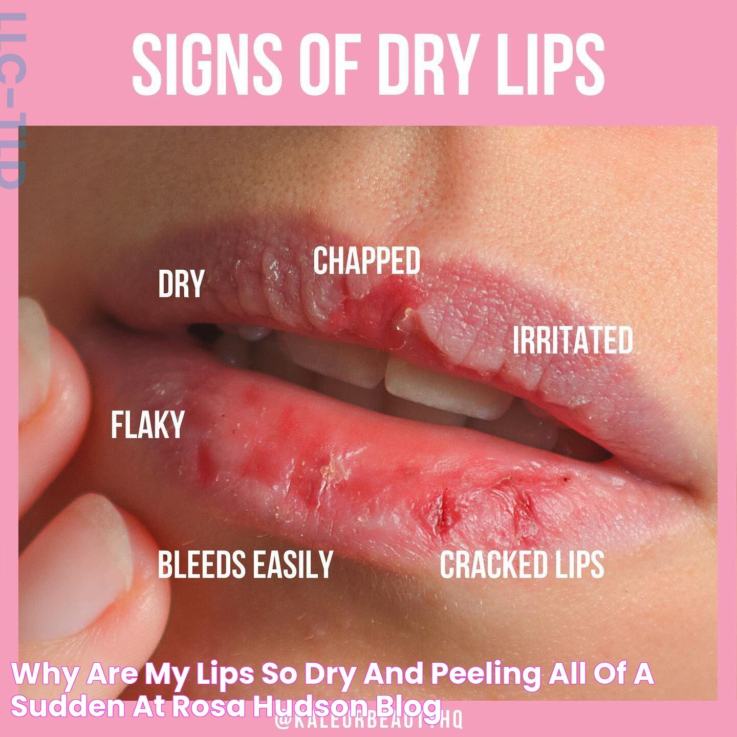 Why Are My Lips So Dry And Peeling All Of A Sudden at Rosa Hudson blog