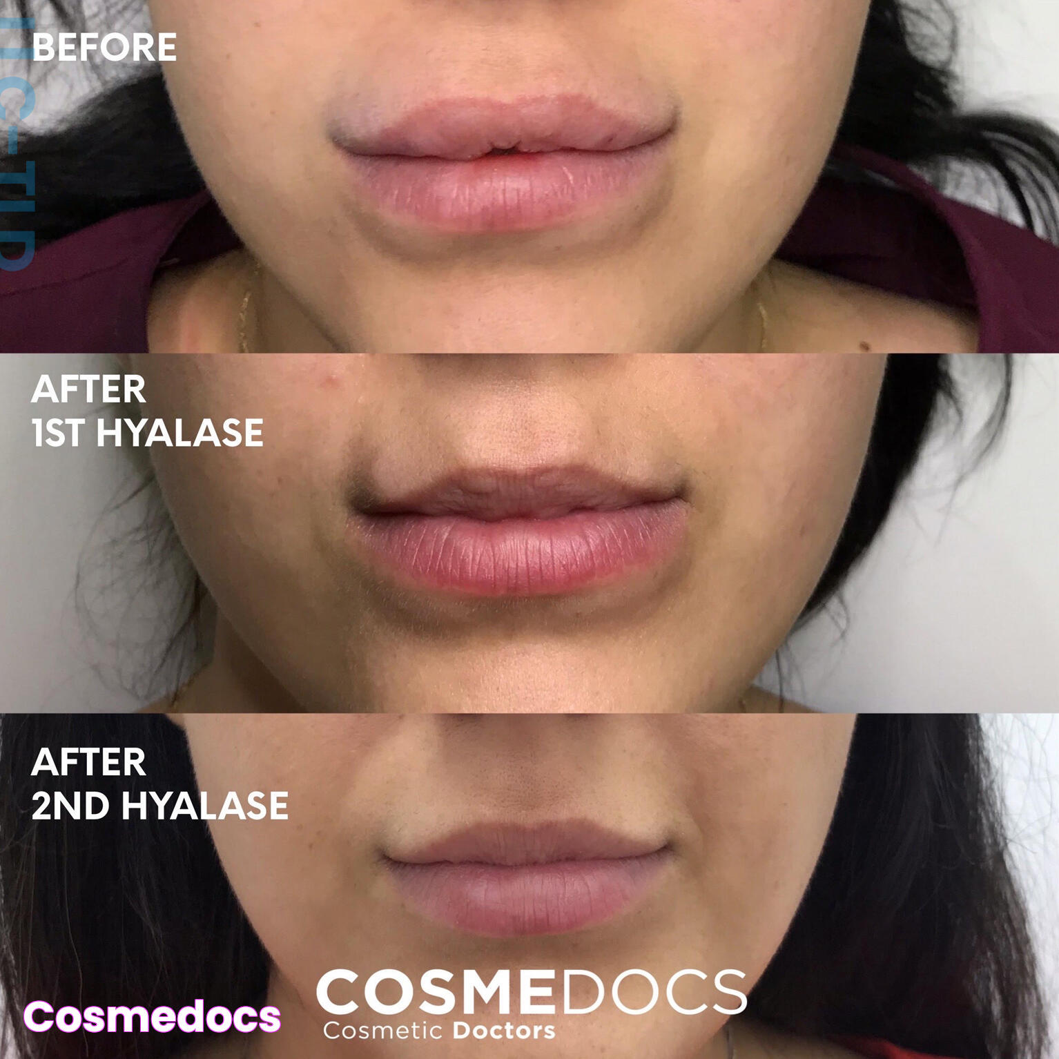  Cosmedocs