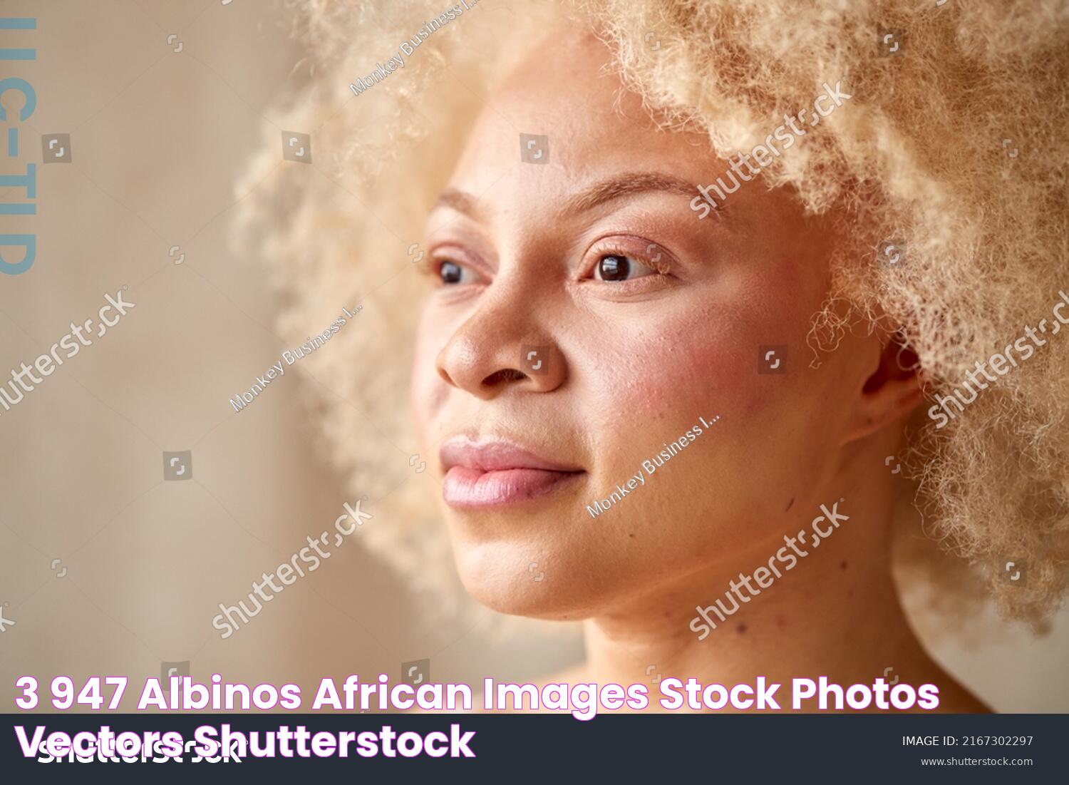 3,947 Albinos African Images, Stock Photos & Vectors Shutterstock