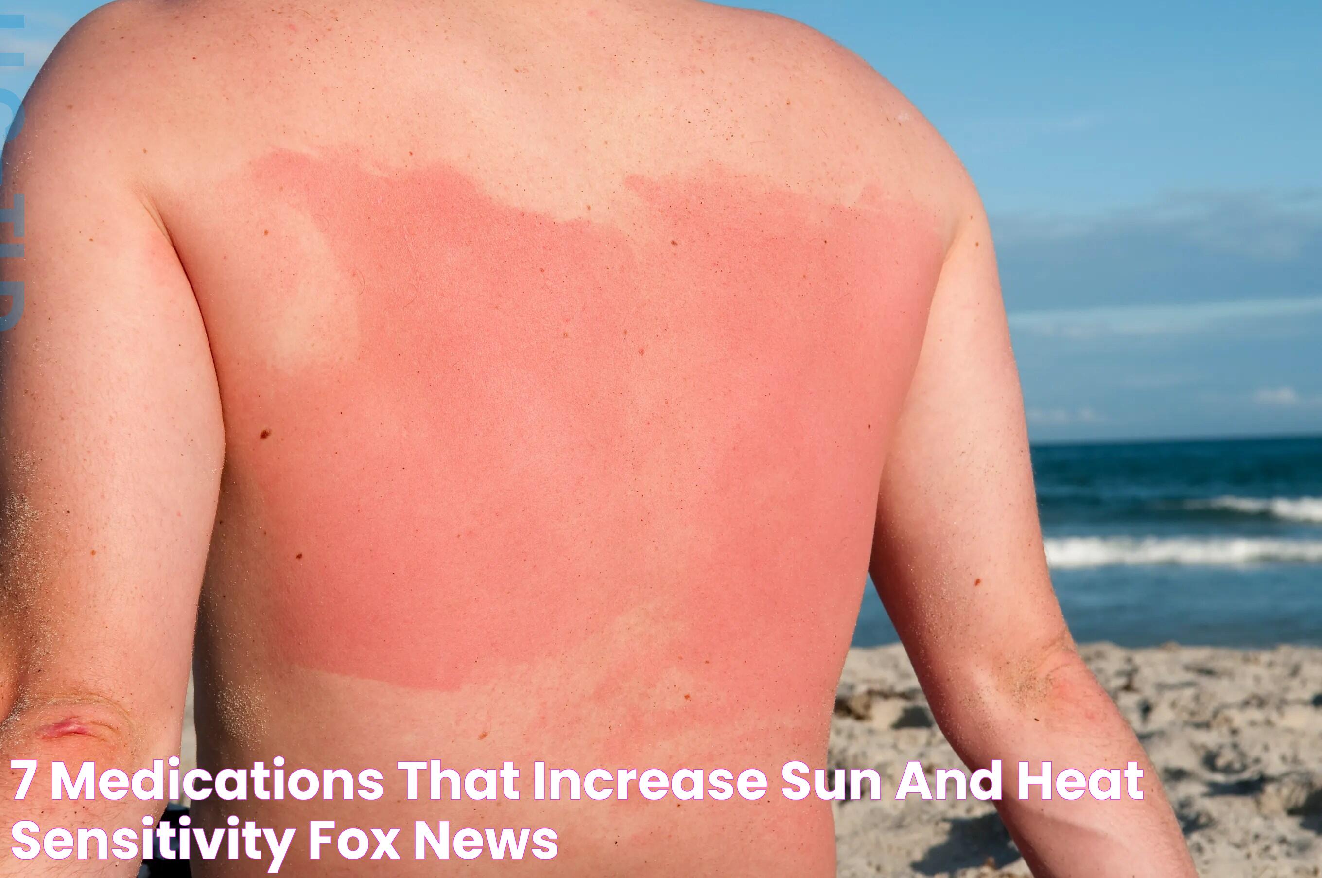 Effective Actions For Sun Poisoning Relief And Prevention