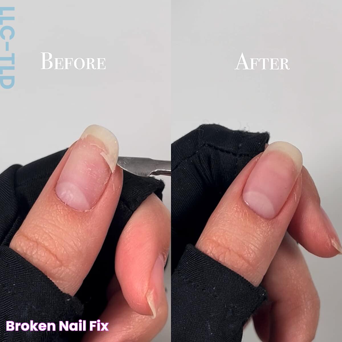 Mastering Nail Care: Repair And Prevention Of Nail Half Broken