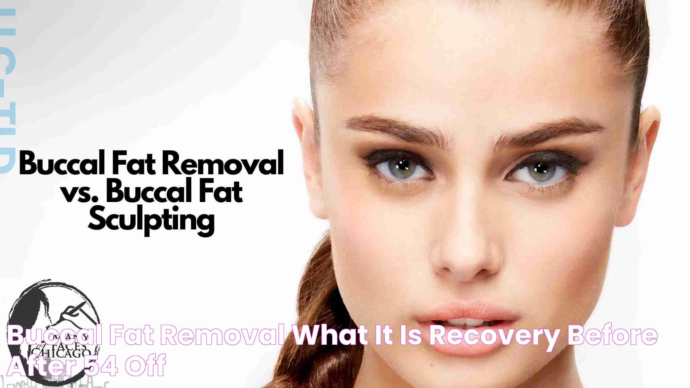 Buccal Fat Removal What It Is, Recovery Before After, 54 OFF