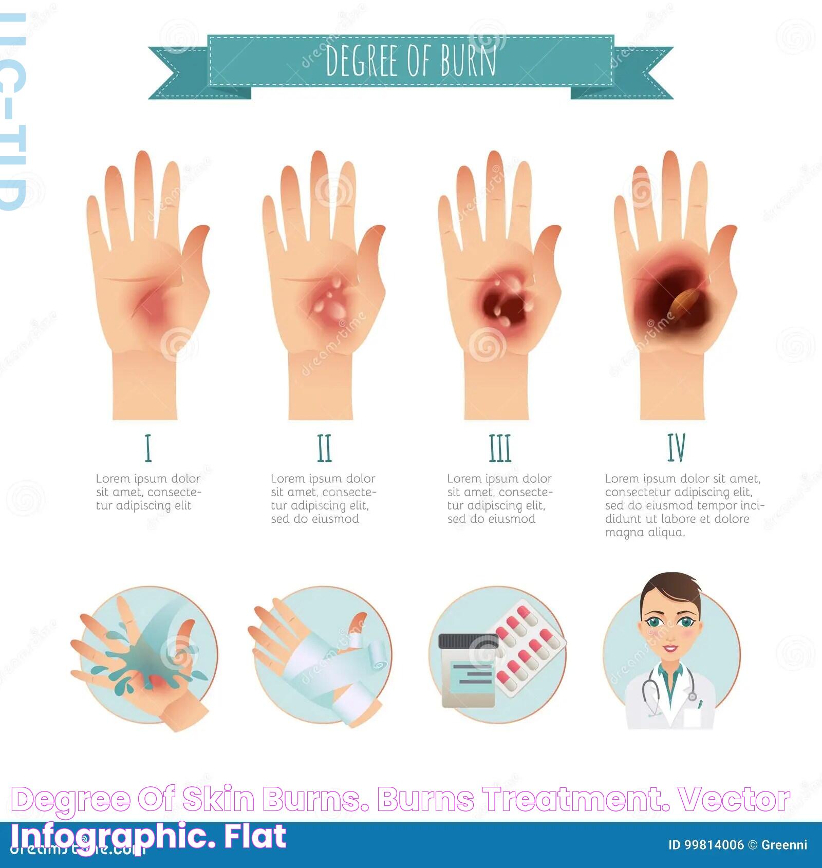 Degree of Skin Burns. Burns Treatment. Vector Infographic. Flat