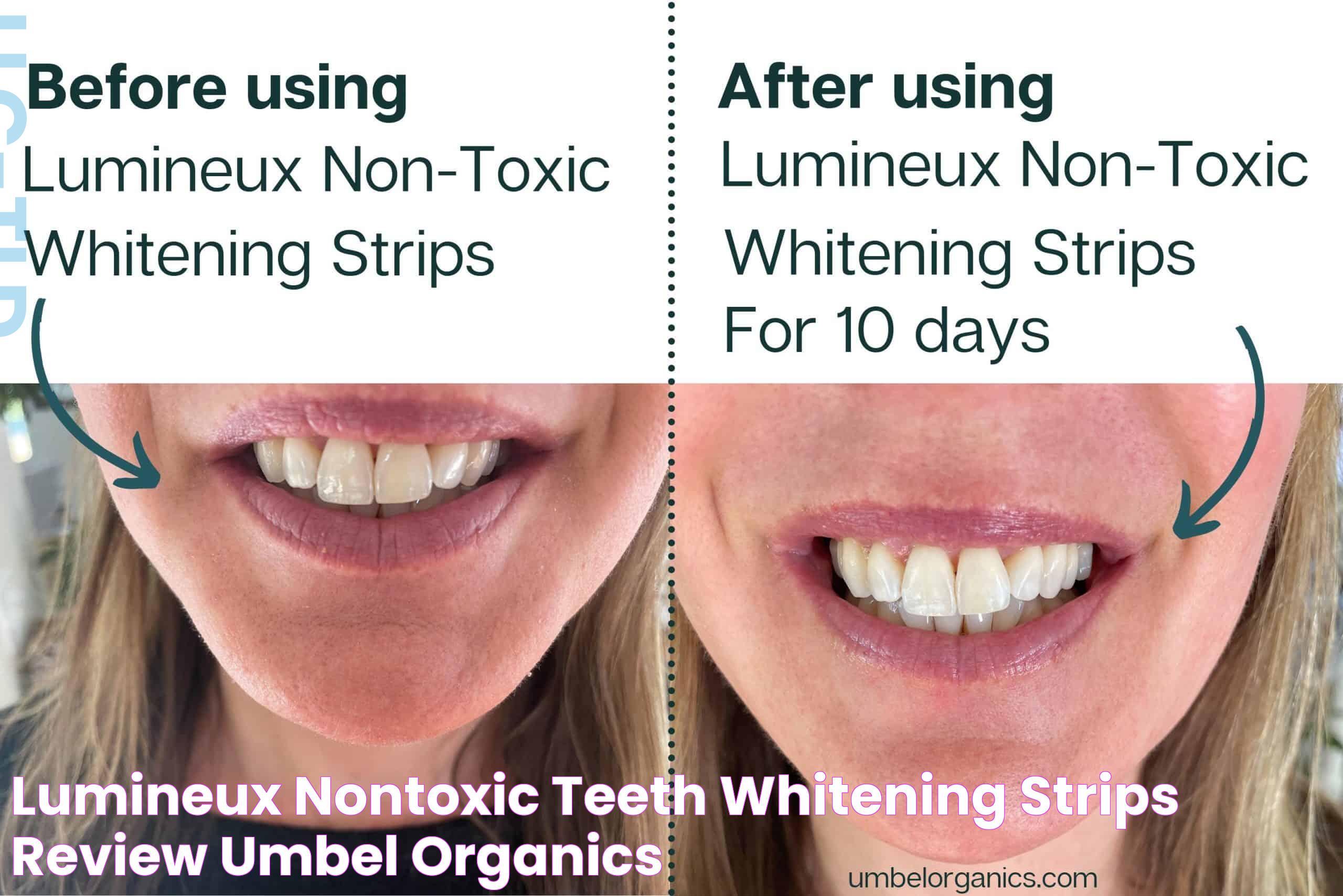 Lumineux NonToxic Teeth Whitening Strips Review Umbel Organics