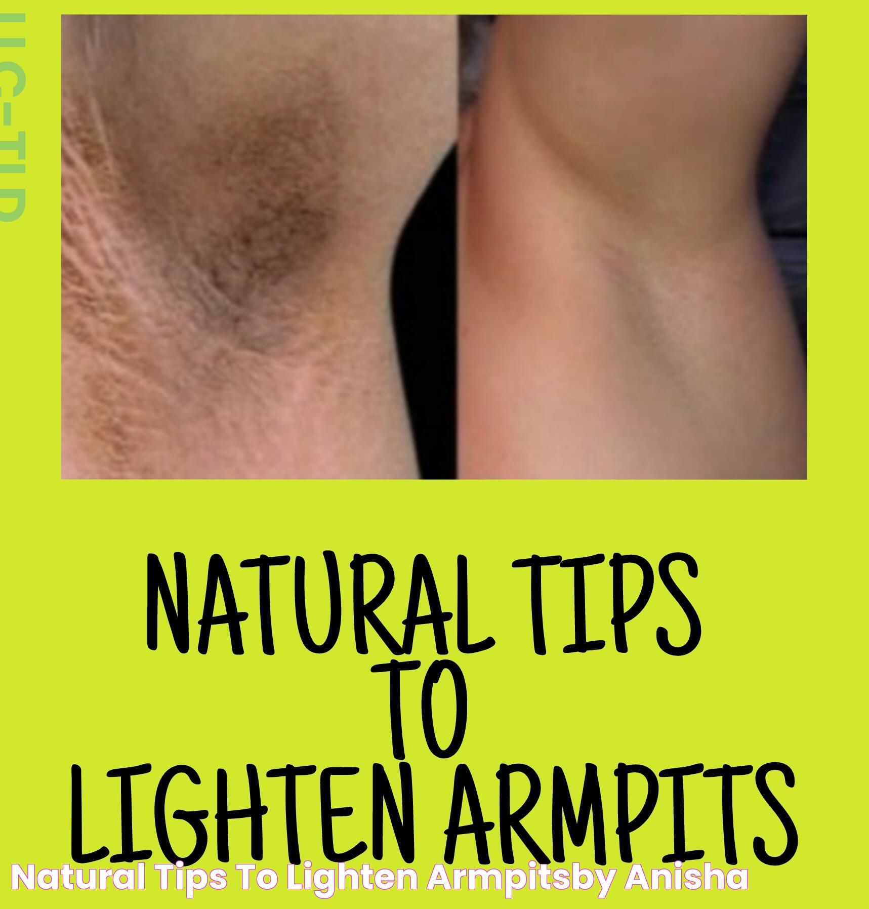 Quick Tips For The Fastest Way To Lighten Armpits