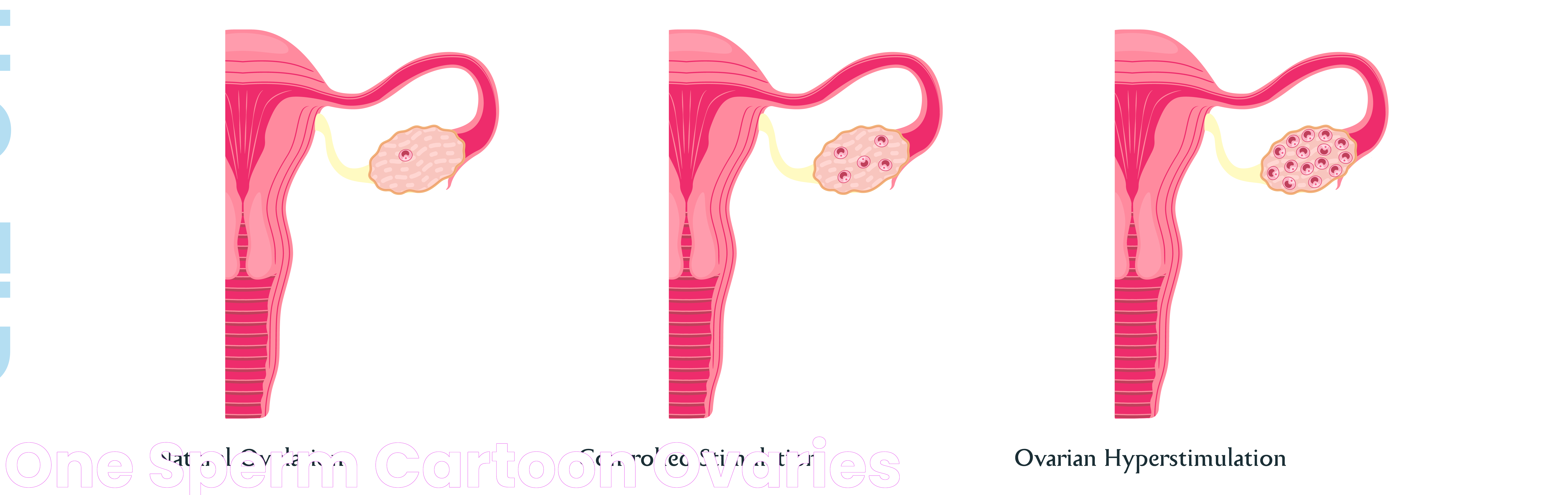 One Sperm Cartoon Ovaries