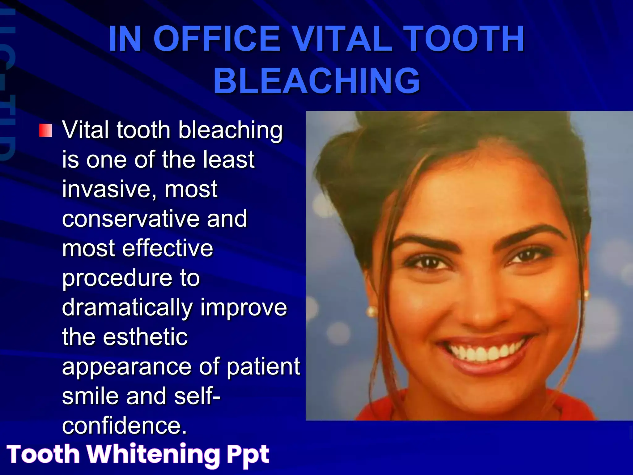 Tooth Whitening: A Bright Smile For Everyone