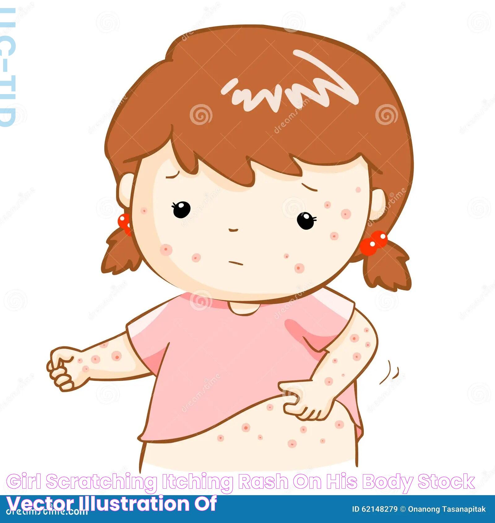 Girl Scratching Itching Rash on His Body Stock Vector Illustration of