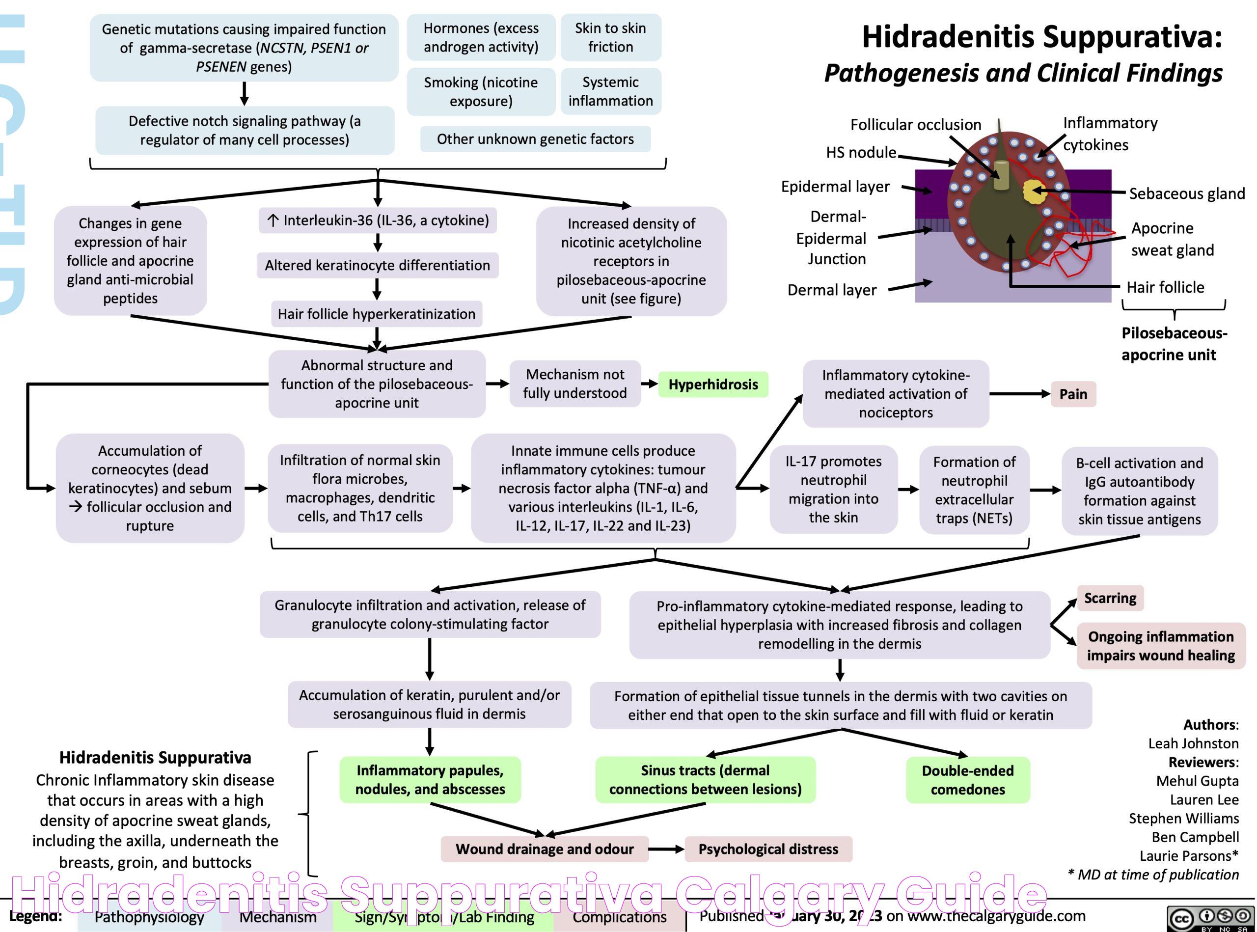 Hidradenitis Suppurativa Calgary Guide