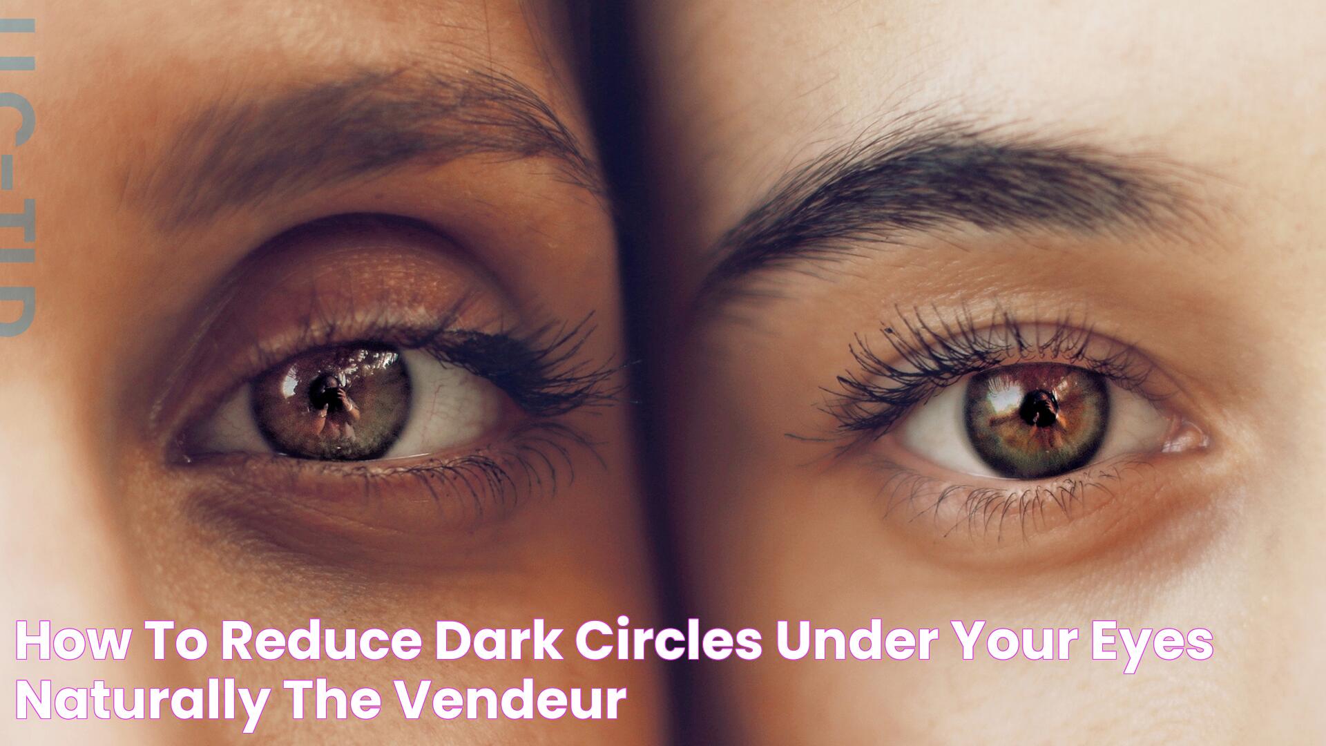 How To Reduce Dark Circles Under Your Eyes Naturally The Vendeur