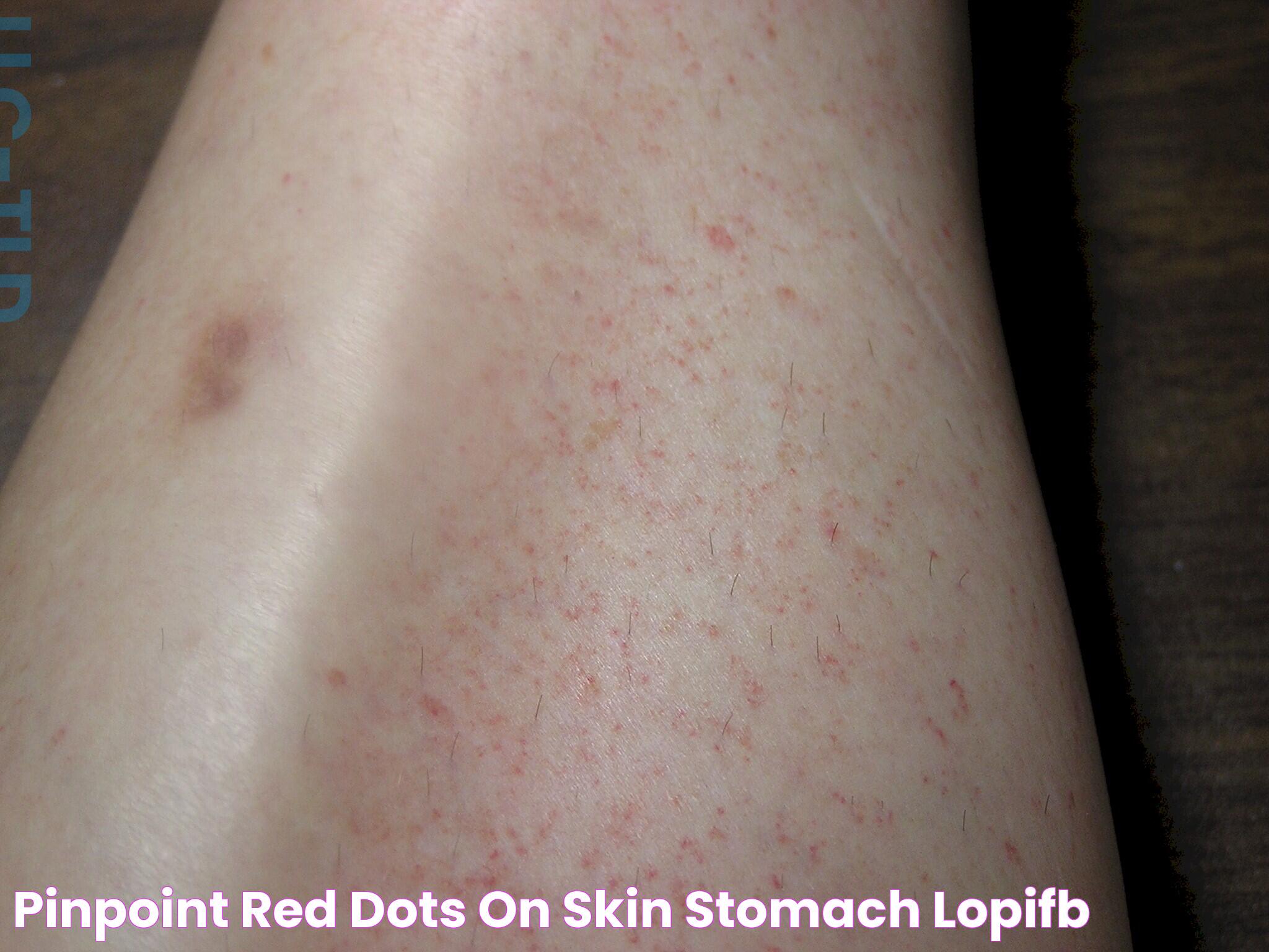 Why Am I Getting Small Red Dots On Skin: Causes And Solutions