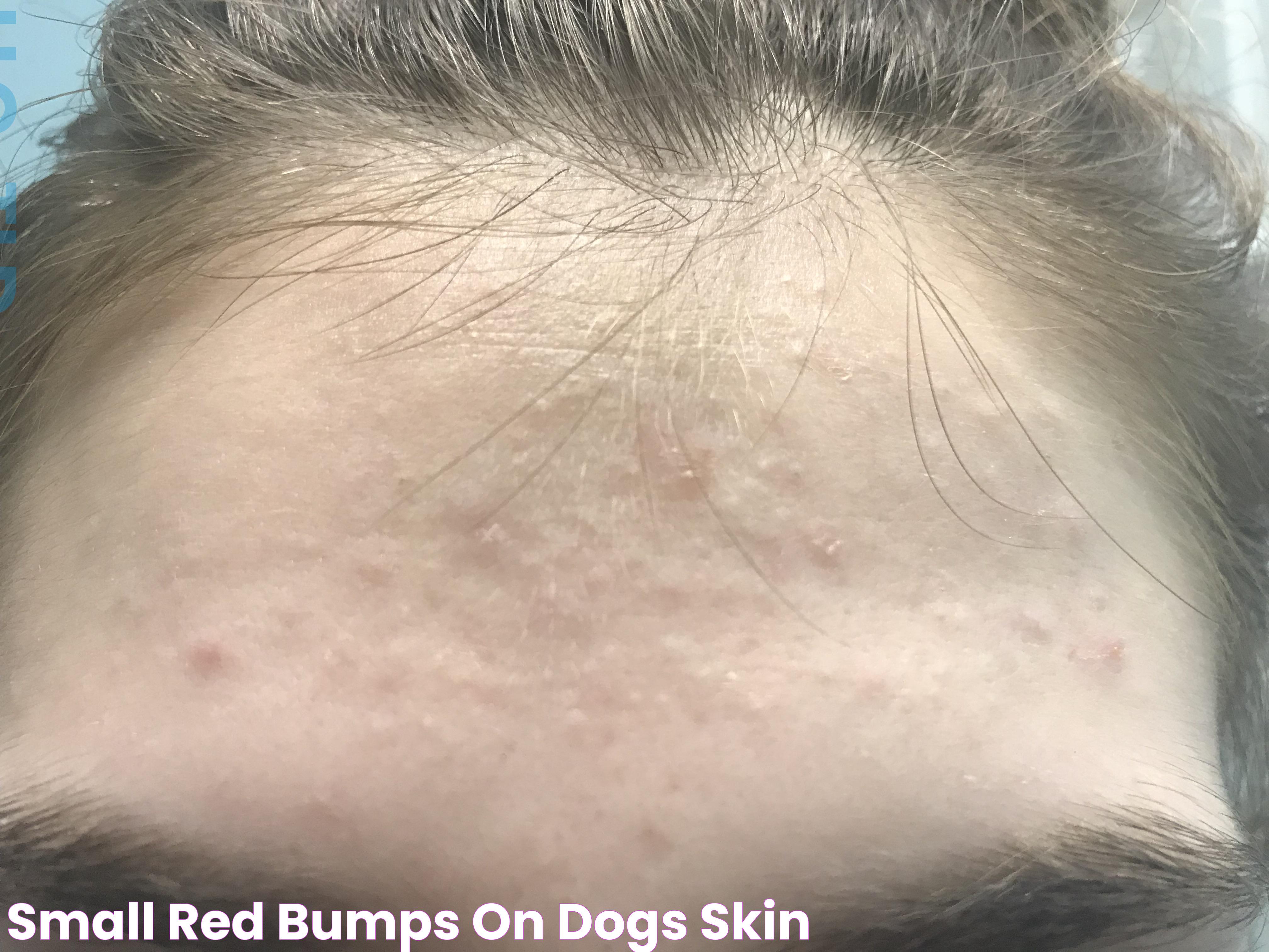 Causes And Solutions Of Small Red Bumps On Skin