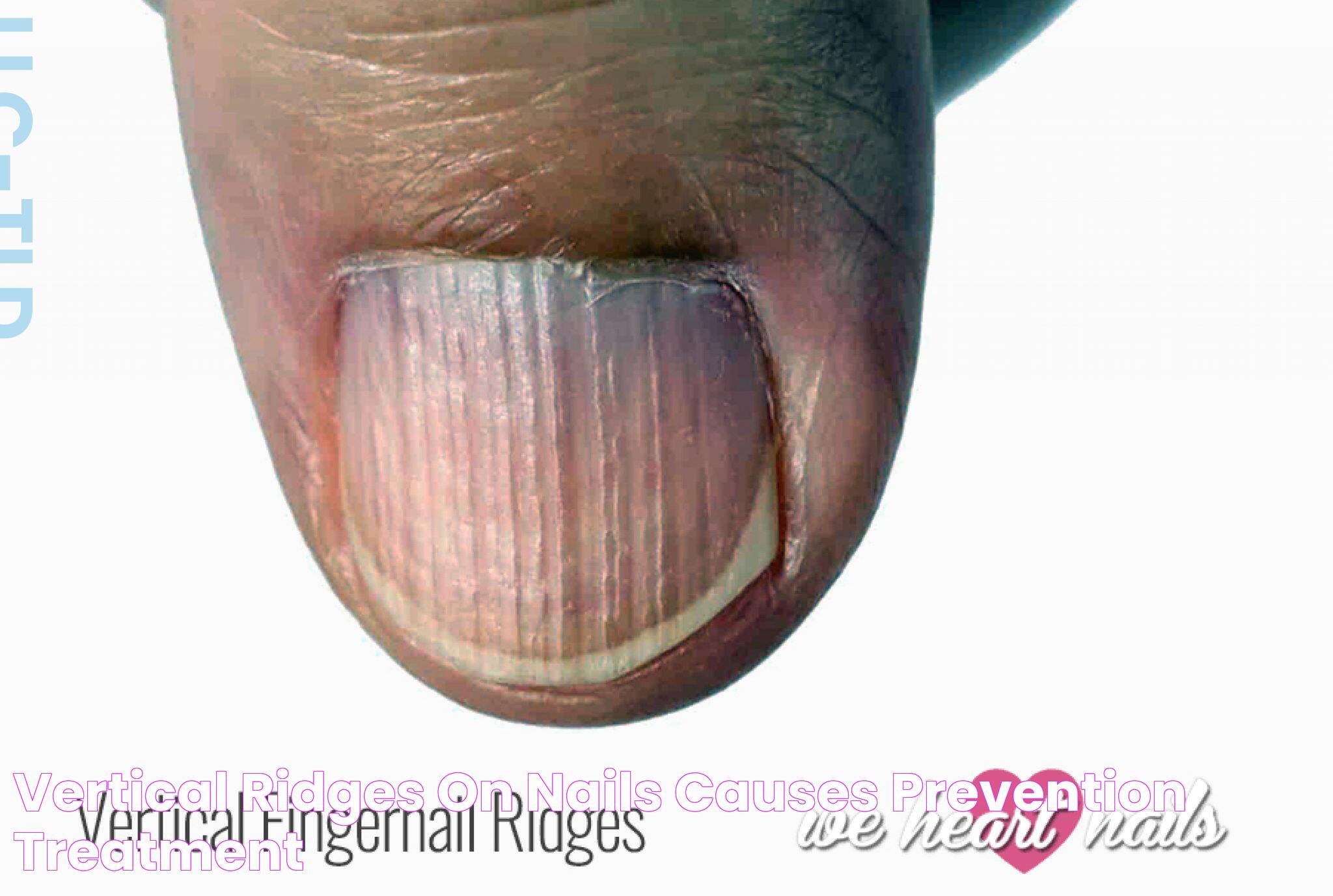 What Your Fingernails Are Telling You: Hidden Health Clues Revealed