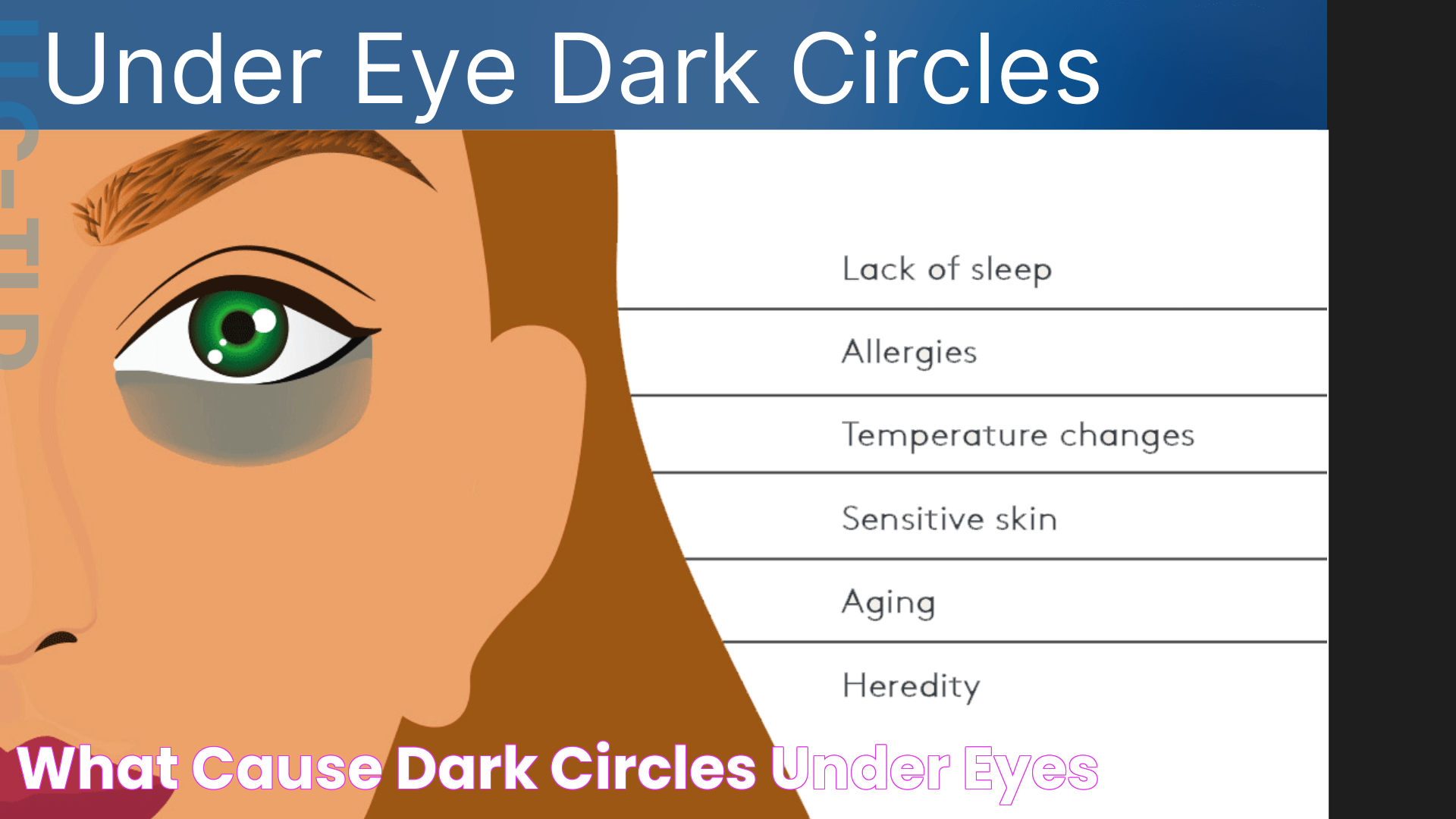 Effective Solutions To Conquer Dark Circles For Radiant Eyes