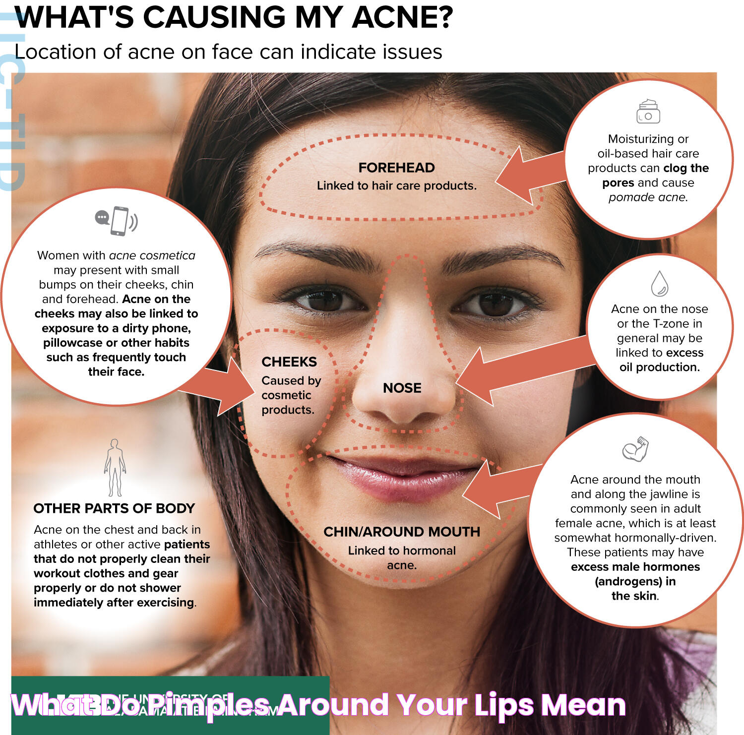 Causes And Solutions For Pimples Around Vagina: A Comprehensive Guide