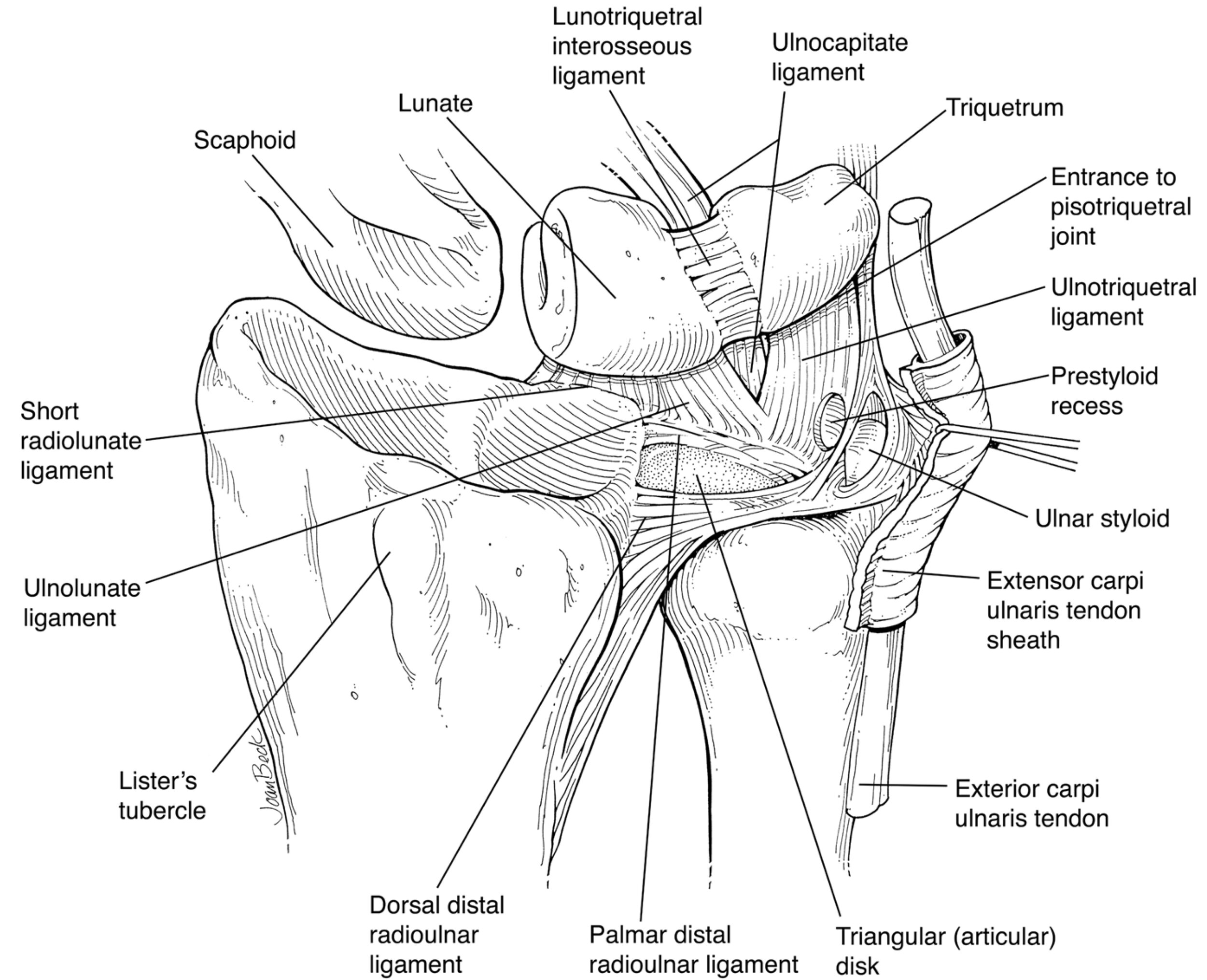 Triangular Fibrocartilage Complex (TFCC) Injury Hand, 43 OFF