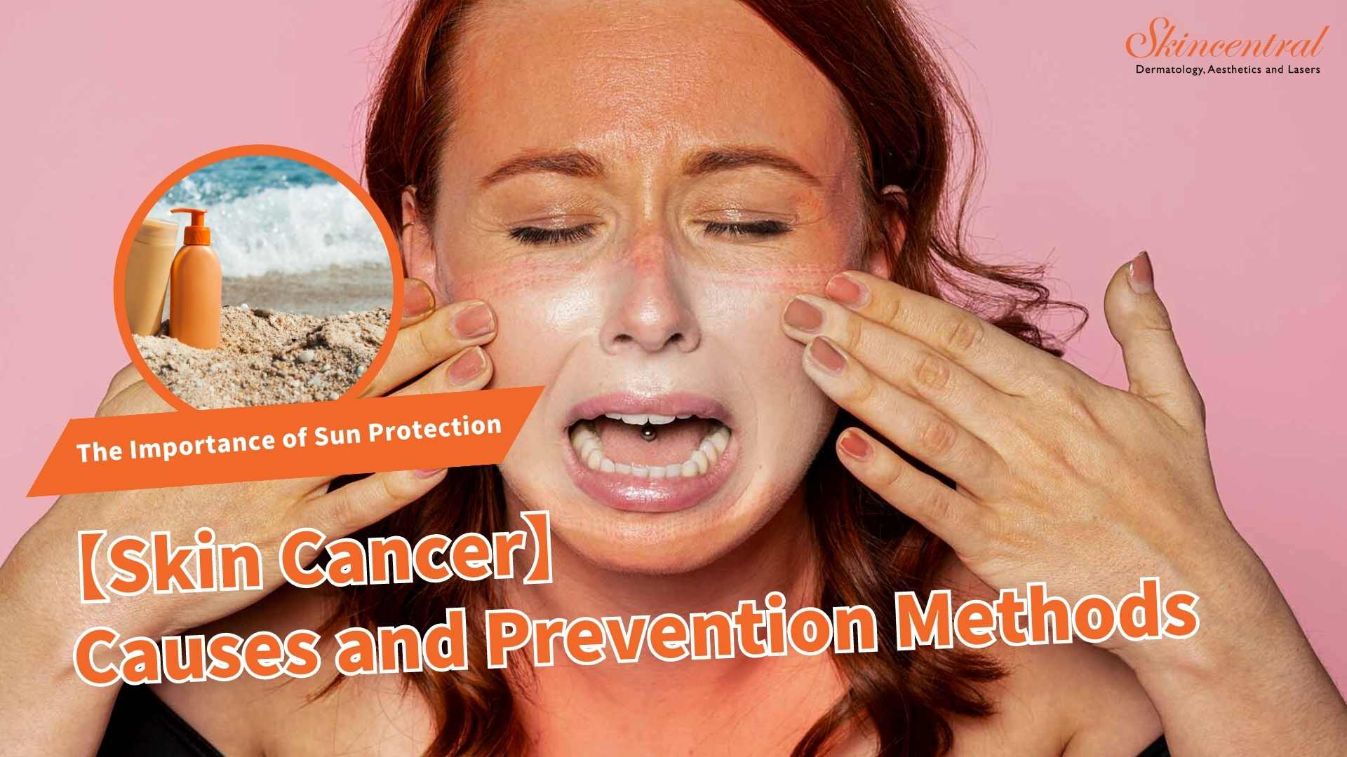 【Skin Cancer】Causes and Prevention Methods The Importance of Sun